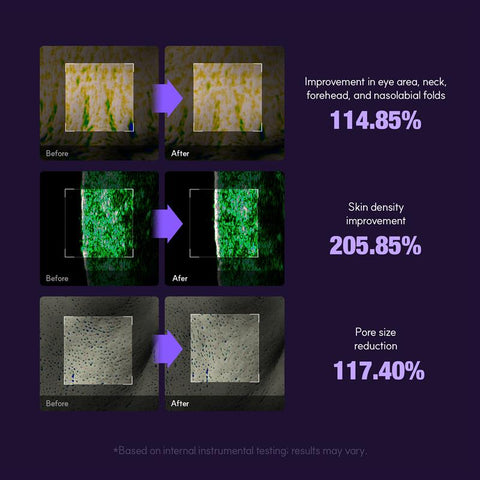 EOA HIFU Fulthera Pro